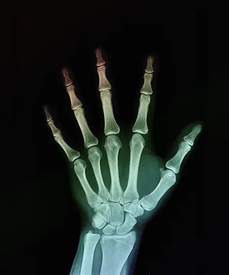 Digital X-Ray